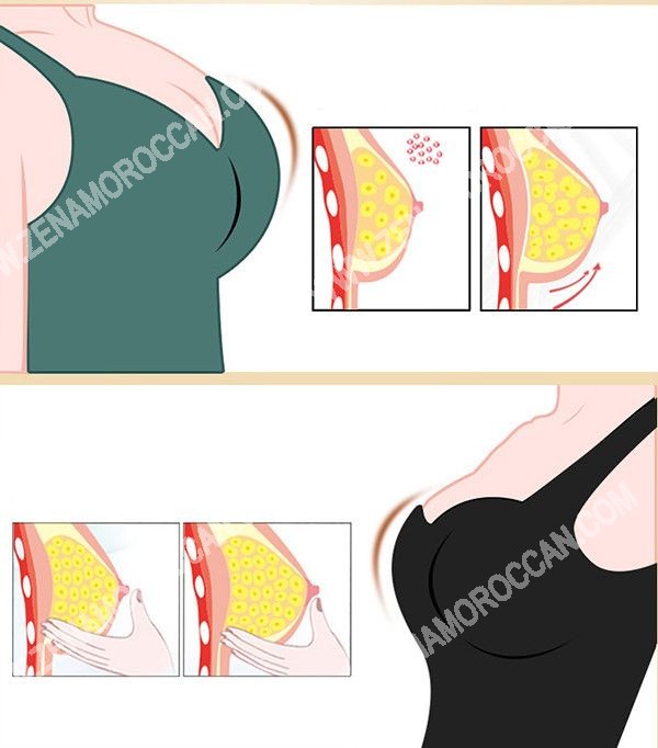 Breast-and-Buttocks-Enlargement-Modern-Pump